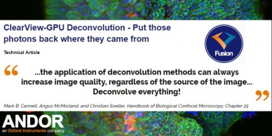 Dekonvoluce v rámci softwaru FUSION pro ovládání mikroskopu Dragonfly 