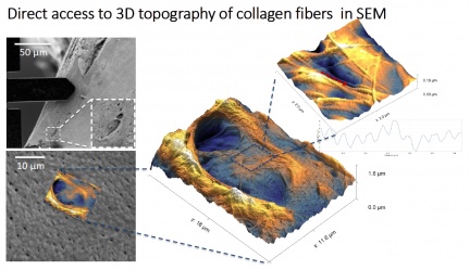 Ukázka měření kolagenových vláken na vzorku kostní tkáně