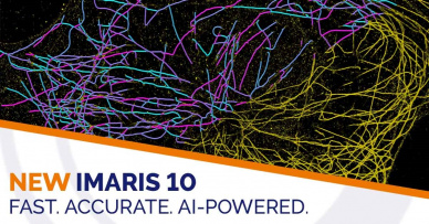 Imaris 10.0 - Trasování filamentárních struktur poháněné umělou inteligencí!