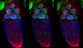 Drosophila melanogaster (egg-chamber, stage 10), snímky pořízené systémem DSD2