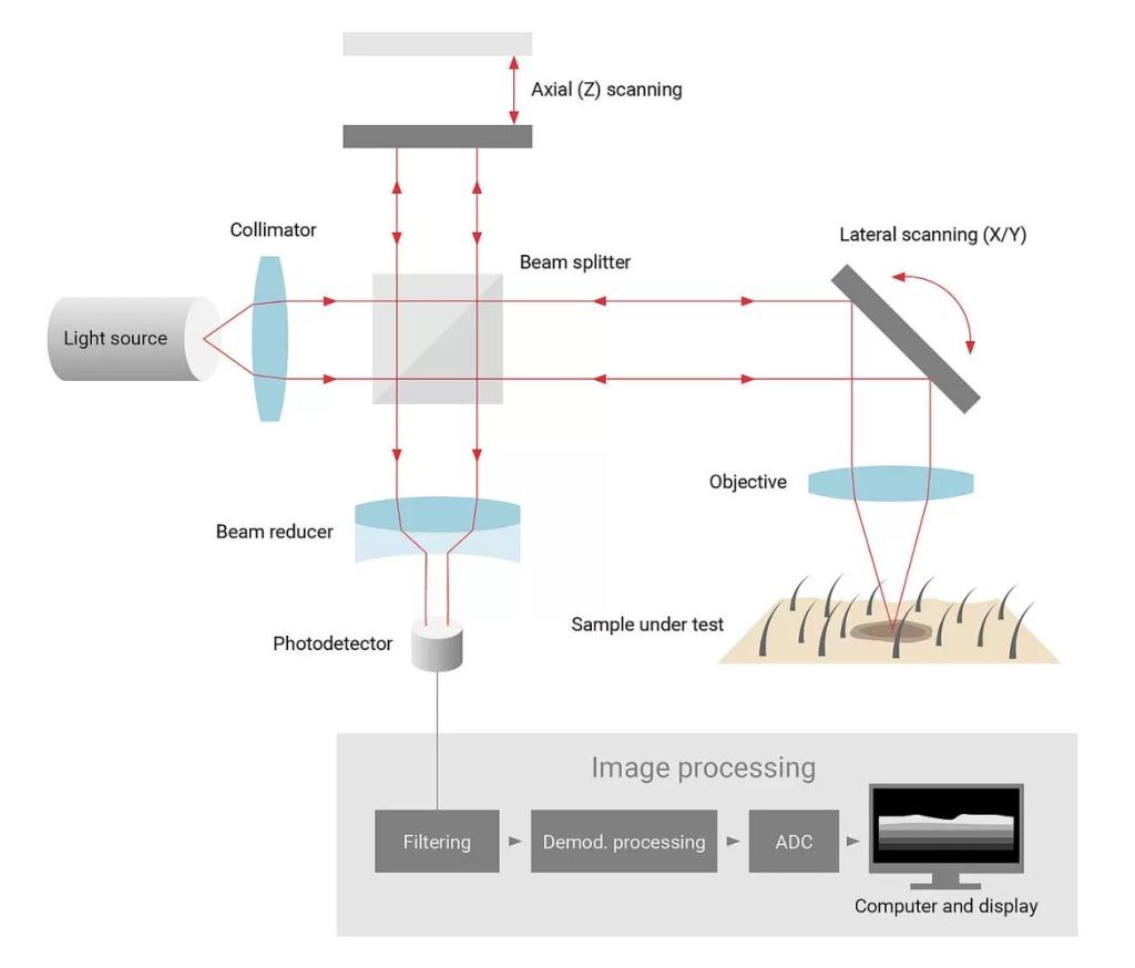 Optical coherence tomography (OCT)